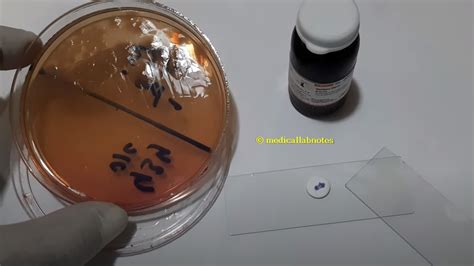pseudomonas aeruginosa oxidase test|Pseudomonas Isolation and Identification: An Introduction to the .